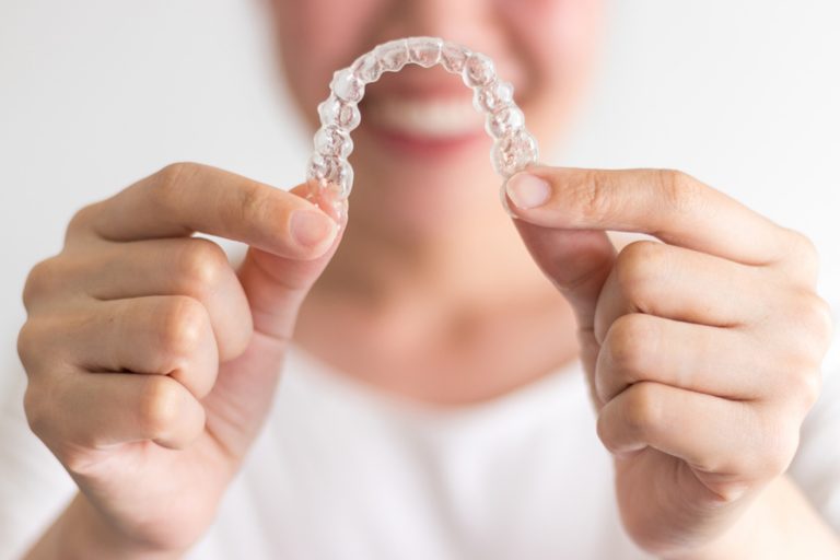 how-long-is-the-invisalign-treatment-the-bachmayer-orthodontic-clinic-blogthe-bachmayer