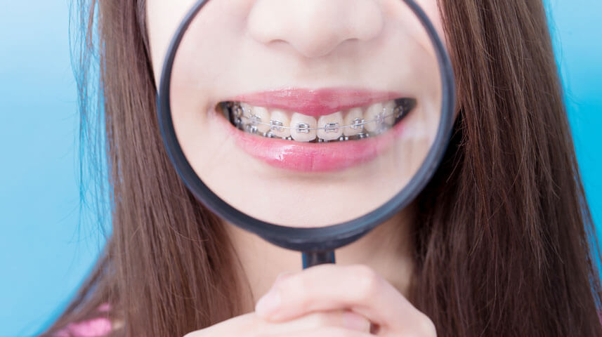 The Different Costs of Ceramic Braces and Traditional Braces