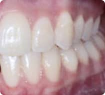 Before & Afters